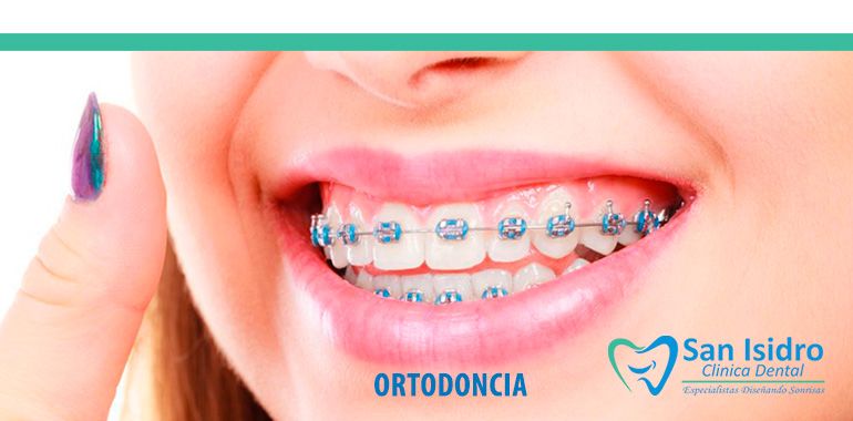 ortodoncia-sjl