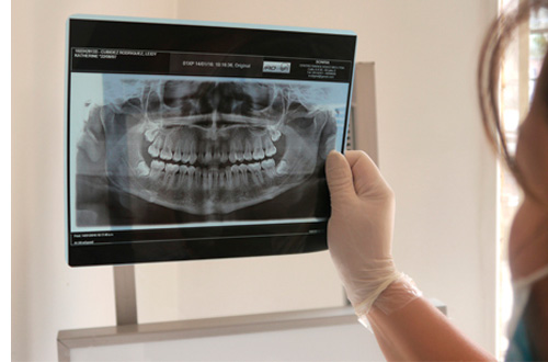 radiologia-oral-y-maxilofacial