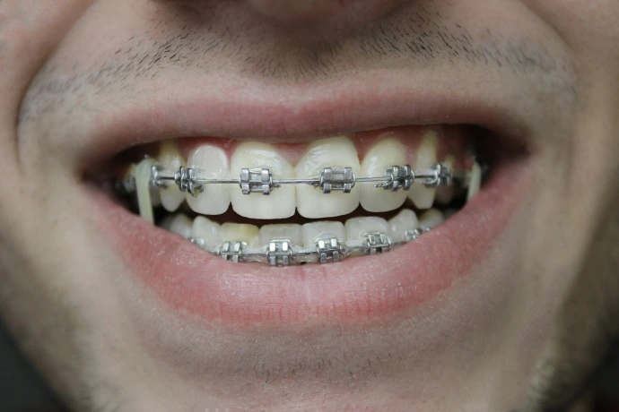 close-up of a person's mouth